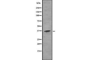 Western blot analysis of Cathepsin H using K562 whole cell lysates (Cathepsin H antibody  (Internal Region))