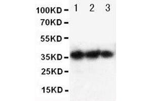 Anti-human EPO antibody, Western blotting Lane 1: Recombinant human EPO Protein 10ng Lane 2: Recombinant human EPO Protein 5ng Lane 3: Recombinant human EPO Protein 2