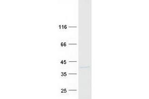 Western Blotting (WB) image for Charged Multivesicular Body Protein 2A (CHMP2A) (Transcript Variant 2) protein (Myc-DYKDDDDK Tag) (ABIN2713981)