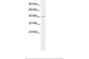 Image no. 1 for anti-Proteasome (Prosome, Macropain) 26S Subunit, Non-ATPase, 4 (Psmd4) (C-Term) antibody (ABIN6735881) (PSMD4/ASF antibody  (C-Term))