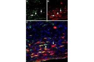 Immunohistochemistry (IHC) image for anti-Nerve Growth Factor Receptor (NGFR) (Soluble) antibody (ABIN7044625)