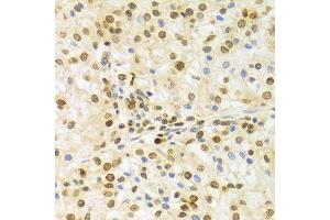 Immunohistochemistry (Paraffin-embedded Sections) (IHC (p)) image for anti-ELAV (Embryonic Lethal, Abnormal Vision, Drosophila)-Like 1 (Hu Antigen R) (ELAVL1) (AA 1-326) antibody (ABIN3022231)