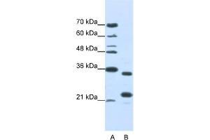 WB Suggested Anti-ALKBH8 Antibody Titration:  1. (ALKBH8 antibody  (N-Term))