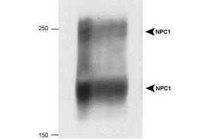 Western blot analysis of NPC1 in 20 ug of human fibroblast cell lysate with NPC1 polyclonal antibody . (NPC1 antibody  (AA 1230-1278))