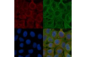 ABIN6257898 and ABIN6275911 staining Hela cells(24h of starvation treatment) by IF/ICC. (Serotonin Receptor 5A antibody  (Internal Region))