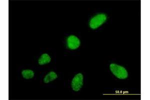 Immunofluorescence of purified MaxPab antibody to SFRS5 on HeLa cell. (SRSF5 antibody  (AA 1-272))