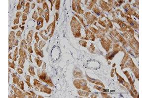 Image no. 1 for anti-NADH Dehydrogenase (Ubiquinone) 1 alpha Subcomplex, 8, 19kDa (NDUFA8) (AA 1-73) antibody (ABIN599409) (NDUFA8 antibody  (AA 1-73))