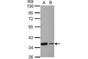 WB Image Sample (30 ug of whole cell lysate) A: NT2D1 B: SK-N-SH 10% SDS PAGE antibody diluted at 1:1000 (HSF2BP antibody)