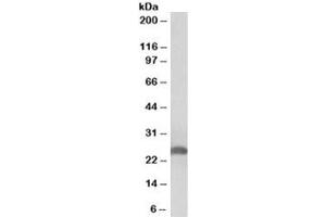 Western blot testing of human liver lysate with Apolipoprotein D antibody at 0. (Apolipoprotein D antibody)