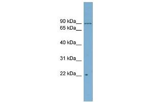 WB Suggested Anti-C12orf11  Antibody Titration: 0. (C12orf11 antibody  (Middle Region))