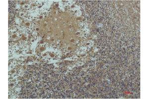 Immunohistochemical (IHC) analysis of paraffin-embedded Human Brain Tissue using a-tubulin(Acetyl Lys40) Mouse Monoclonal Antibody diluted at 1:200. (alpha Tubulin antibody  (acLys40))
