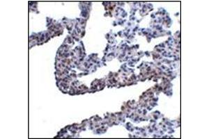 Immunohistochemistry of PCDH12 in rat lung tissue with this product at 5 μg/ml. (PCDH12 antibody  (N-Term))