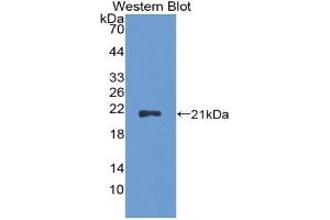 Detection of Recombinant CDKN2A, Rat using Polyclonal Antibody to Cyclin Dependent Kinase Inhibitor 2A (CDKN2A) (CDKN2A antibody  (AA 3-155))