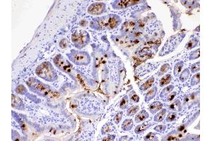 IHC analysis of MUC2 using anti-MUC2 antibody . (MUC2 antibody)