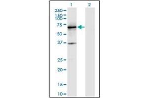 Western Blotting (WB) image for anti-Protein Tyrosine Phosphatase, Receptor Type, N (PTPRN) antibody (ABIN954381) (PTPRN antibody)