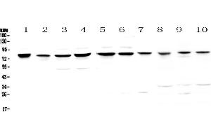 Western blot analysis of PARN using anti-PARN antibody .