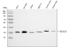 Western blot analysis of RPAIN using anti-RPAIN antibody (ABIN7602348).
