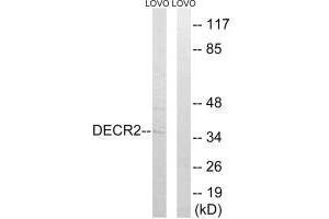 Western blot analysis of extracts from LOVO cells, using DECR2 antibody. (DECR2 antibody)