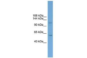 WB Suggested Anti-ZNF628 Antibody Titration:  0.