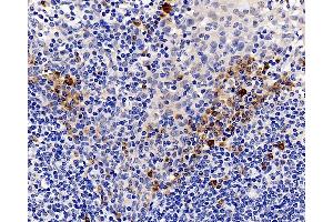 Immunohistochemistry analysis of paraffin-embedded human tonsil using CASP1 Polyclonal Antibody at dilution of 1:300. (Caspase 1 antibody)