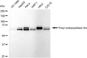 Western blotting analysis using Prolyl endopeptidase like antibody (ABIN7799923).