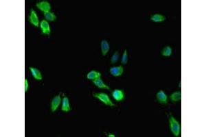 Immunofluorescent analysis of Hela cells using ABIN7159407 at dilution of 1: 100 and Alexa Fluor 488-congugated AffiniPure Goat Anti-Rabbit IgG(H+L) (Menin antibody  (AA 1-615))