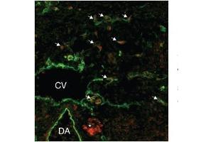 Human lymphatic endothelial; lymphatic endothelial cell tissue and primary (1/50 up to 1/500) secondary 1/200; SOX18 antibody - middle region in Human lymphatic endothelial cells using Immunofluorescence (SOX18 antibody  (Middle Region))