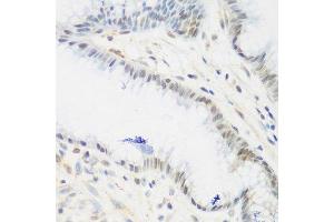 Immunohistochemistry of paraffin-embedded human stomach using IGF2BP3 antibody. (IGF2BP3 antibody  (AA 300-579))