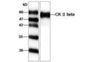 Image no. 1 for anti-Casein Kinase 2, beta (CSNK2B) antibody (ABIN791461) (CSNK2B antibody)
