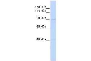 WB Suggested Anti-RAD54B Antibody Titration:  0. (RAD54B antibody  (Middle Region))