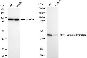 Western blotting analysis using fumarate hydratase antibody (ABIN7798664). (FH antibody)