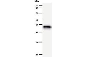 Western Blotting (WB) image for anti-SMAD, Mothers Against DPP Homolog 1 (SMAD1) antibody (ABIN933125) (SMAD1 antibody)
