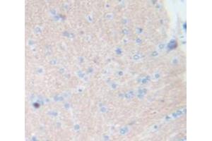 Used in DAB staining on fromalin fixed paraffin- embedded Kidney tissue (Tachykinin 3 antibody  (AA 29-102))