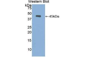Western Blotting (WB) image for anti-Gelsolin (GSN) (AA 432-553) antibody (ABIN1078060) (Gelsolin antibody  (AA 432-553))