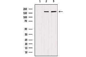 Western blot analysis of extracts from various samples, using MYOM2 Antibody. (MYOM2 antibody  (Internal Region))