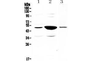 Western blot analysis of PAI1 using anti-PAI1 antibody . (PAI1 antibody  (AA 24-240))