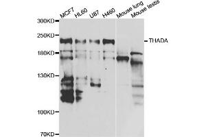 Western blot analysis of extracts of various cell lines, using THADA antibody (ABIN5974287) at 1/1000 dilution. (THADA antibody)
