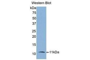 Western Blotting (WB) image for anti-Interleukin 6 Receptor (IL6R) (AA 19-108) antibody (ABIN3206013) (IL-6 Receptor antibody  (AA 19-108))
