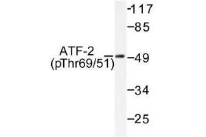 Image no. 1 for anti-Activating Transcription Factor 2 (ATF2) (pThr51), (pThr69) antibody (ABIN317965) (ATF2 antibody  (pThr51, pThr69))