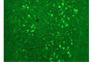 Immunostaining of rat cerebellum showing fluorescence of calretinin containing cells. (Calretinin antibody)