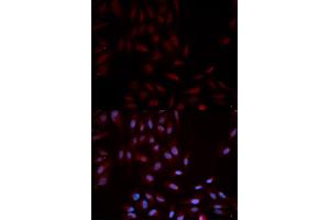 Immunofluorescence analysis of U2OS cells using Phospho-MAPK14-Y322 antibody (ABIN5969909). (MAPK14 antibody  (pTyr322))