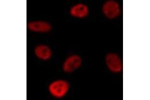 ABIN6275694 staining HepG2 by IF/ICC. (ZNF771 antibody  (Internal Region))