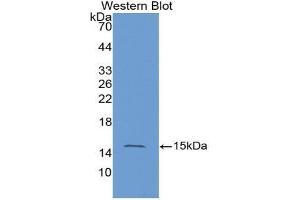 Western blot analysis of the recombinant protein. (HRAS antibody  (AA 82-176))