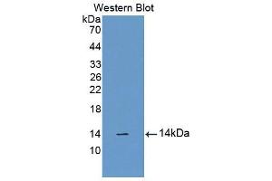 Western blot analysis of the recombinant protein. (CUBN antibody  (AA 3511-3623))