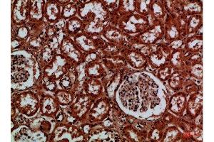 Immunohistochemical analysis of paraffin-embedded Human-kidney, antibody was diluted at 1:100 (EYA1 antibody)