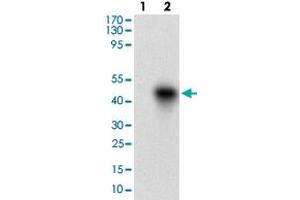 Western blot analysis of Lane 1: Negative control [HEK293 cell lysate]; Lane 2: Over-expression lysate [ROR2 (AA: 59-155)-hIgGFc transfected HEK293 cells] with ROR2 monoclonal antibody, clone 6F2D10  at 1:500-1:2000 dilution. (ROR2 antibody  (AA 59-155))
