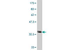 Western Blot detection against Immunogen (37 KDa) . (HMGCS1 antibody  (AA 422-520))