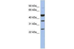WB Suggested Anti-MAGEB3 Antibody Titration: 0. (MAGEB3 antibody  (N-Term))