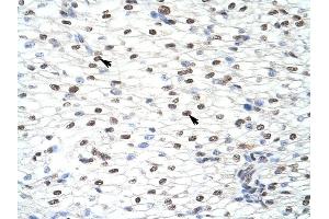 CUGBP2 antibody was used for immunohistochemistry at a concentration of 4-8 ug/ml to stain Myocardial cells (arrows) in Human Heart. (CELF2 antibody  (N-Term))