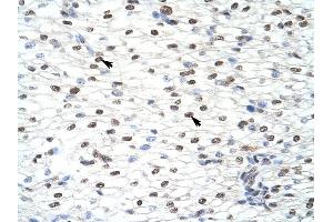 CUGBP2 antibody was used for immunohistochemistry at a concentration of 4-8 ug/ml to stain Myocardial cells (arrows) in Human Heart.